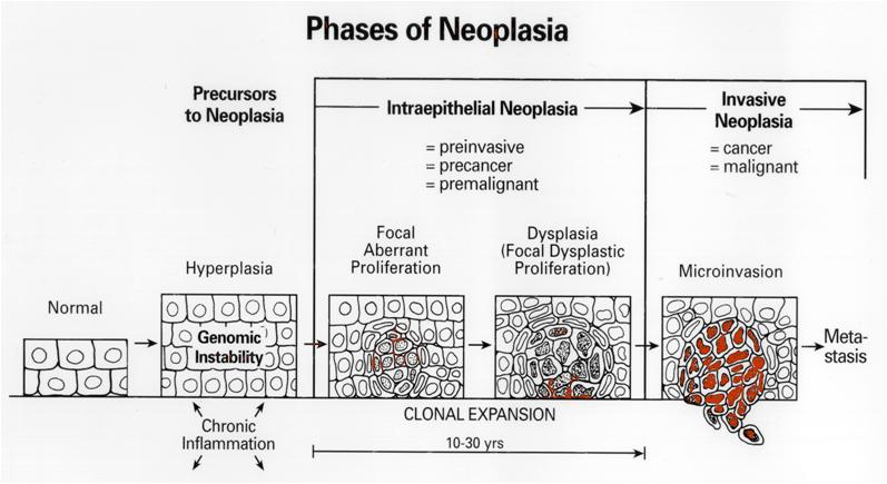 Phases of Neoplasia